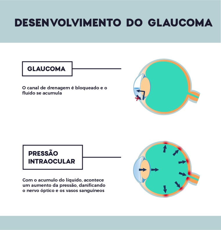 conheça o tratamento que pode dispensar o uso de colírios HOlhos